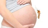 Thai phụ nhiễm virus Zika sinh con không dị tật