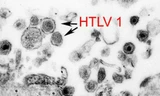 Virus HTLV-1. Ảnh: bodypro. 