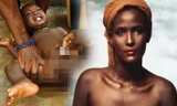 Ám ảnh kinh hoàng về quá khứ bị cắt bỏ âm vật của siêu mẫu gốc Phi 