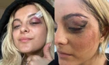 Bebe Rexha gặp xui: Bị fan cuồng ném điện thoại vào đầu, vé concert rẻ bèo chỉ 1 đôla