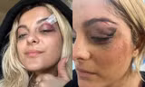 Bebe Rexha gặp xui: Bị fan cuồng ném điện thoại vào đầu, vé concert rẻ bèo chỉ 1 đôla