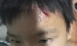 Làm rõ tin tố giác mẹ kế bạo hành con chồng ở Cà Mau