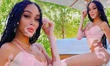 Winnie Harlow thư giãn bên hồ bơi với bikini nhỏ xíu