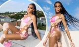 Siêu mẫu Winnie Harlow diện bikini thả dáng gợi cảm trên mái nhà