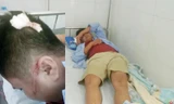 Anh Yên và anh Công nhập viện sau khi bị truy sát.