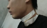 Anh T. bị thương ở cổ.