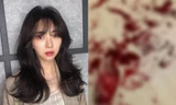Mina (AOA) đăng ảnh cổ tay đầy máu, khẳng định: “Các người chẳng biết gì về tôi cả”