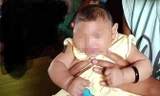 Trẻ sơ sinh nghi mắc chứng đầu nhỏ tại Đắk Lắk