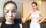 Tai nạn không may này đã khiến cô ca sĩ xinh đẹp phải hoảng sợ và lo lắng, bên cạnh việc phải huỷ hết lịch làm việc của mình, điều Yến Trang âu lo nhất là việc để lại sẹo trên gương mặt của mình. 