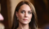 Tình trạng Công nương Kate