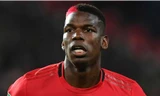 Paul Pogba sẽ tái xuất trong tháng tới?