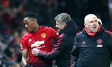 Anthony Martial vắng mặt ở trận gặp Burnley vì chấn thương.