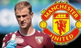 M.U muốn mua Joe Hart để thế chỗ De Gea.