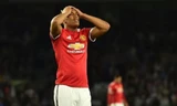 Martial chắc chắn vắng mặt ở chung kết FA Cup vì chấn thương.