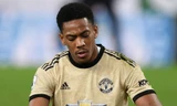 Anthony Martial bất ngờ dính chấn thương.