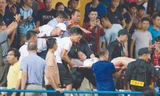 Nữ cổ động viên được đưa lên cáng đi cấp cứu sau khi bị trúng pháo sáng vào đùiảnh: VSI