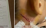 Công an Hà Nội điều tra vụ cháu bé 11 tuổi bị cứa cổ, hành hạ khi câu cá tại ao nhà hàng xóm