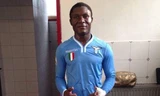 Khuôn mặt già hơn vài chục tuổi của tài năng trẻ Joseph Minala. Ảnh: Daily Mail 