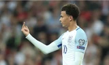 Hành vi phản cảm của Dele Alli. Ảnh: Michael Zemanek.