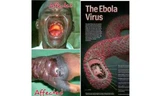 Cận cảnh người bị bệnh do vi rút Ebola. 