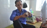 Ông Nguyễn Văn Sơn - một nạn nhân bị rắn lục đuôi đỏ cắn đang điều trị tại bệnh viện.