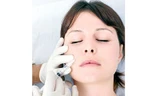 Tiêm Botox giảm chứng đau nửa đầu
