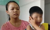 Quảng Nam: Giáo viên mầm non bị tố đánh trẻ chấn động não