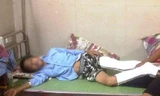 Em Q. đang nằm điều trị tại bệnh viện đa khoa Ninh Bình sau khi nhảy từ tầng 3 xuống đất, bị gãy và vỡ xương chân.