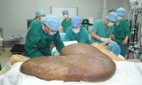 Người đàn ông có khối u nặng 110kg