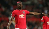M.U sẽ mất Paul Pogba thêm một tháng.
