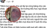 Công an vào cuộc xác minh vụ cô giáo ở Hải Phòng bị tố "đánh thâm tím mông các học sinh"