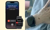Apple Watch tự gọi cứu hộ, cứu sống chủ nhân bị tai nạn ô tô
