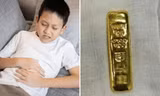 Bé trai ở Trung Quốc thấy bụng bị sưng, hóa ra bé đã nuốt một thỏi vàng lớn
