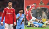 Manchester United thua, pha “chơi xấu” của Cristiano Ronaldo đang bị chỉ trích thế nào?