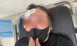 Hà Nội: Một phụ nữ tố bị người đi ô tô dùng dùi cui đập vào đầu vì không tránh đường