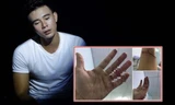 Đông Hùng và bàn tay bị chém rách khiến nhiều người xôn xao.