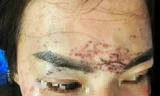 Khởi tố vụ án người phụ nữ 'tố' bị bắt giữ, đánh đập, xăm mặt vì ghen 
