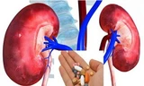 Thuốc giảm đau paracetamol và giảm đau đông y: Nên sử dụng như thế nào thì tốt?