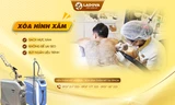 Viện Thẩm Mỹ Ladova giúp hàng nghìn người xóa xăm thành công mỗi năm