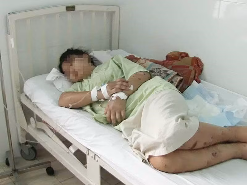 Vụ cô gái 18 tuổi bị tra tấn đến sẩy thai: Bắt tạm giam một đối tượng ảnh 3 Vụ cô gái 18 tuổi bị tra tấn đến sẩy thai: Bắt tạm giam một đối tượng ảnh 3