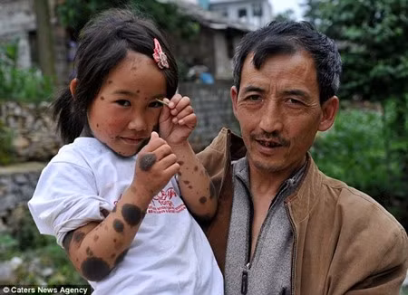 Ông nội của Liu Jiangli chăm sóc cháu gái
