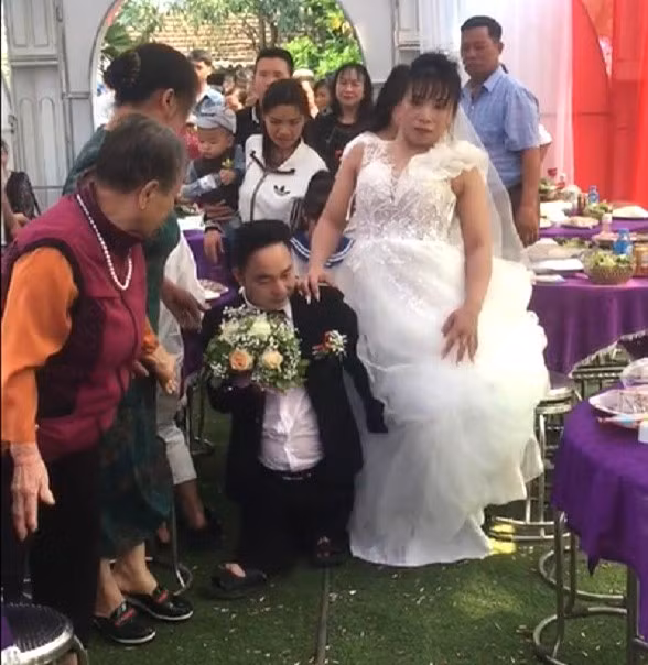 Sau một lần bị tai nạn giao thông, đôi chân của cô dâu không còn được lành lặn như trước. Sau một lần bị tai nạn giao thông, đôi chân của cô dâu không còn được lành lặn như trước.