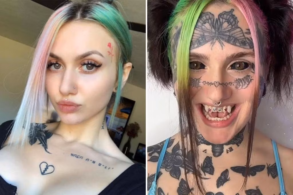 Kierstyn Milligan trước và sau khi thực hiện các thủ thuật biến đổi ngoại hình. Ảnh: NYPost. Kierstyn Milligan trước và sau khi thực hiện các thủ thuật biến đổi ngoại hình. Ảnh: NYPost.