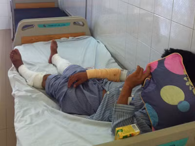 Bệnh nhân Phạm Văn T. đang điều trị tại Viện Bỏng quốc gia. Ảnh T.Hà