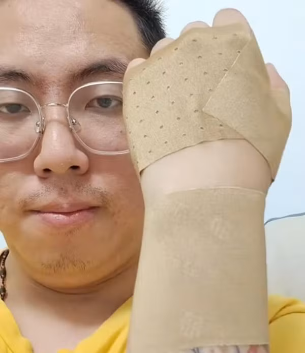 Vì bế con nhiều nên người cha này bị viêm khớp, phải băng tay lại. Ảnh: Baidu. Vì bế con nhiều nên người cha này bị viêm khớp, phải băng tay lại. Ảnh: Baidu.