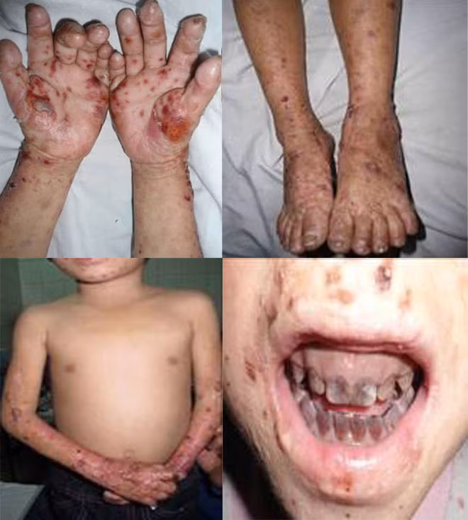 Hình ảnh tổn thương da và răng của bé Tr. Ảnh bác sĩ cung cấp