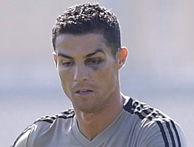 Vì Juventus, Ronaldo sẵn sàng ‘gạt bỏ’ chấn thương và ĐTQG ảnh 1