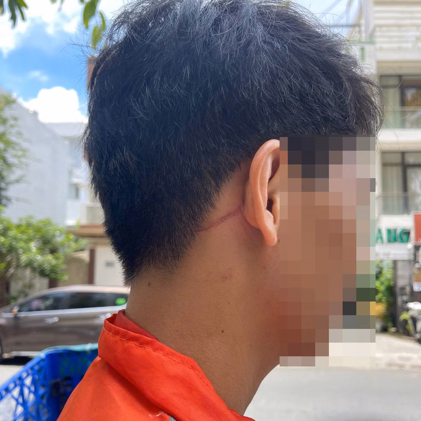 Vết thương trên vùng đầu anh P. do bị đánh. Ảnh: C.A.