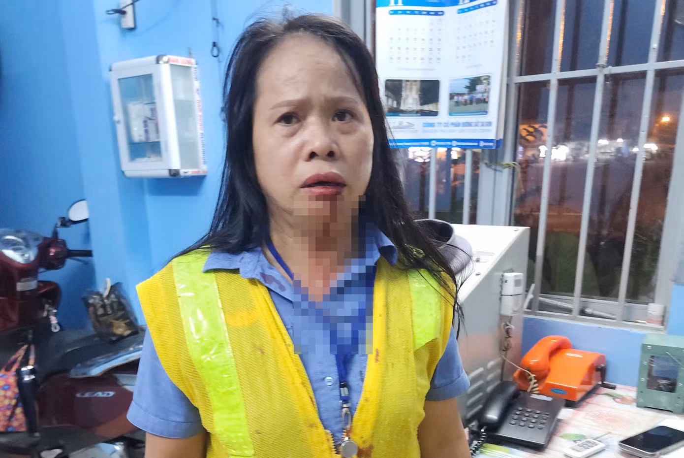 Bà Bình bị hành hung khi đang làm nhiệm vụ. Ảnh: A.X. Bà Bình bị hành hung khi đang làm nhiệm vụ. Ảnh: A.X.