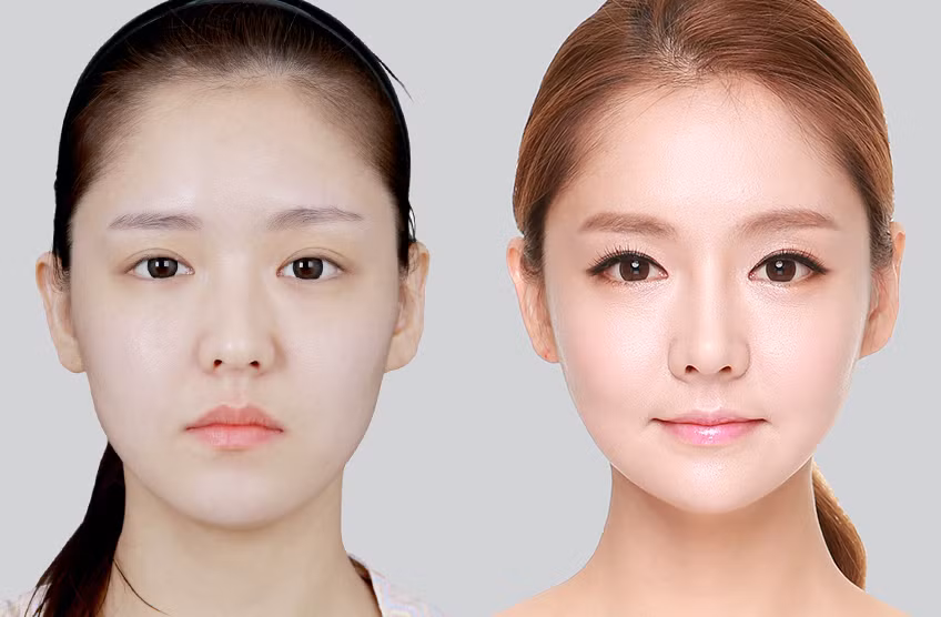 Định hình khuôn mặt Mewing: “Hô biến” cho khuôn mặt sắc nét không cần dao kéo? ảnh 2
